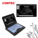 CONTEC CMS600P2 ultrasonic machine portable ultrasonic diagnostic ultrasound system-EspoirDent Shop