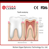 High quality Cheese dental equipment for surgery laser-EspoirDent Shop